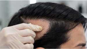 Ficou muito escuro e uniforme