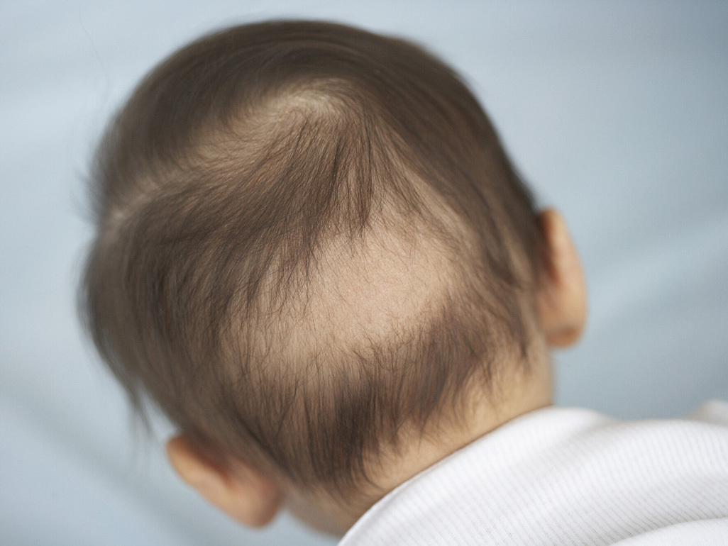 Queda de Cabelo do Bebê: É Normal e Tem Explicação Científica