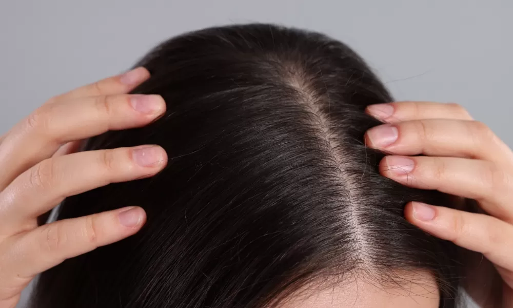 Quantidade de shampoo do tamanho de uma moeda de 25 centavos aplicada na mão antes de levar ao couro cabeludo