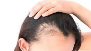 Quais são as principais causas da queda de cabelo?